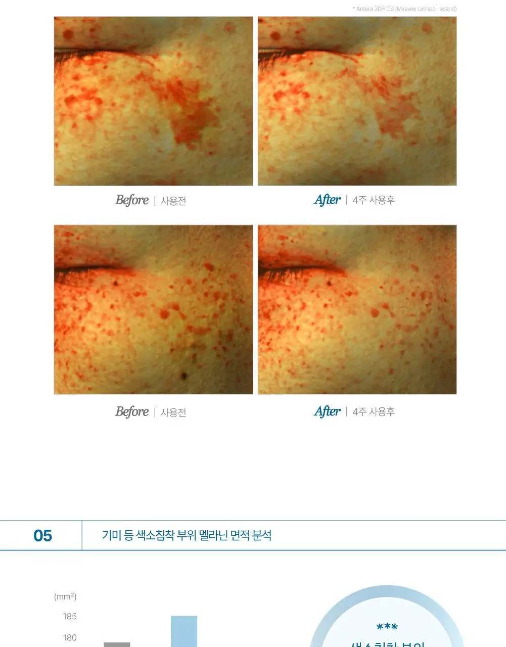 [리뷰이벤트] 라보타치 다크스팟 케어 패치 32매 상세페이지 34